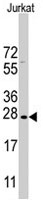 PAB4903 - Claudin-1 / CLDN1
