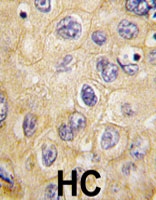 PAB4903 - Claudin-1 / CLDN1