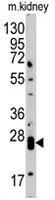 PAB4904 - Claudin-1 / CLDN1