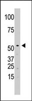 PAB4907 - SPPL2A
