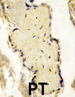 PAB4907 - SPPL2A