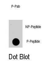 PAB4918 - AKT1 / PKB