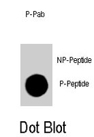 PAB4921 - CDKN1B / KIP1
