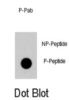 PAB4924 - DNMT1