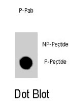 PAB4926 - GATA6