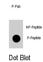 PAB4934 - TERT