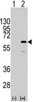 PAB4937 - ELK1