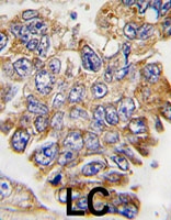 PAB4939 - GRB2 / ASH