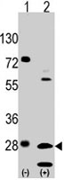 PAB4939 - GRB2 / ASH