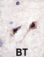 PAB4940 - MEF2C
