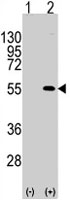PAB4940 - MEF2C