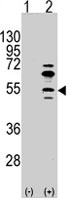 PAB4942 - MEF2C