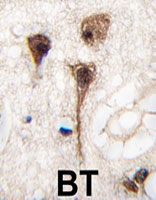 PAB4943 - MEF2C