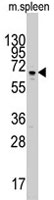 PAB4966 - PARP3