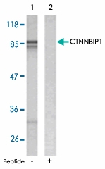 PAB5216 - CTNNBIP1