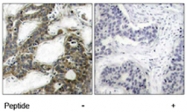 PAB5216 - CTNNBIP1