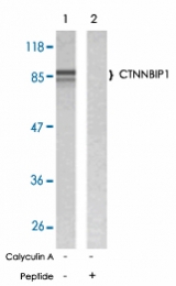PAB5217 - CTNNBIP1