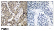 PAB5217 - CTNNBIP1