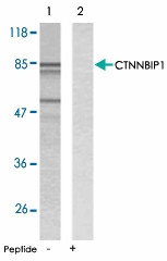 PAB5218 - CTNNBIP1