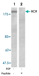 PAB5270 - BCR