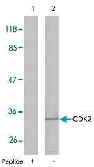 PAB5286 - CDK2