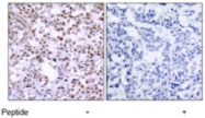 PAB5293 - CHK2