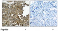PAB5302 - Cofilin-1