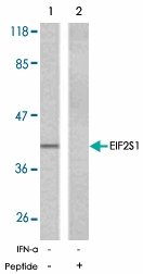 PAB5339 - EIF2A / EIF2S1