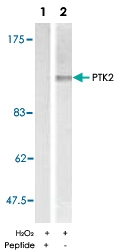 PAB5358 - FAK1 / PTK2