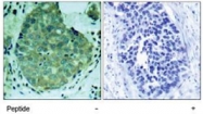 PAB5358 - FAK1 / PTK2