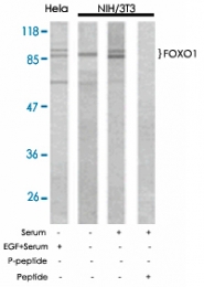 PAB5362 - FOXO1A