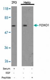 PAB5363 - FOXO1A