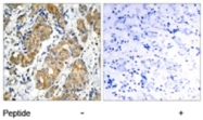 PAB5378 - GSK3 alpha