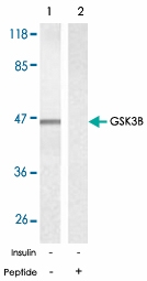 PAB5379 - GSK3 beta