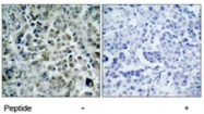 PAB5387 - HDAC8
