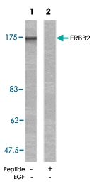 PAB5391 - CD340 / ERBB2 / HER2