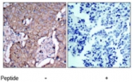 PAB5391 - CD340 / ERBB2 / HER2