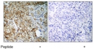 PAB5399 - CD221 / IGF1R