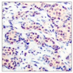 PAB5423 - Jun-D