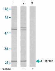 PAB5497 - CDKN1B / KIP1