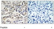 PAB5497 - CDKN1B / KIP1