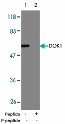 PAB5500 - DOK1 / p62 dok