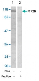 PAB5540 - FAK2 / PTK2B