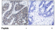PAB5540 - FAK2 / PTK2B