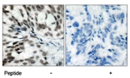 PAB5552 - Retinoblastoma-associated protein / RB1