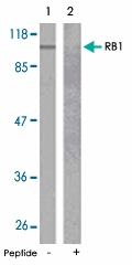 PAB5554 - Retinoblastoma-associated protein / RB1