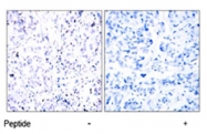 PAB5554 - Retinoblastoma-associated protein / RB1