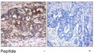 PAB5574 - SHC1 / SHC
