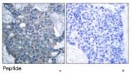 PAB5597 - Stathmin / STMN1