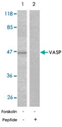 PAB5624 - VASP
